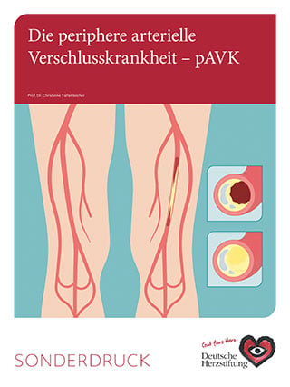 Titelbild Die periphere arterielle 
Verschlusskrankheit – pAVK