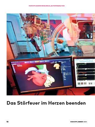 Vorhofflimmern: Behandlung Mit Katheterablation | Herzstiftung