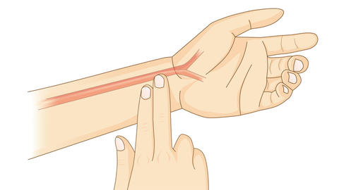 Abbildung vom Puls messen an Handgelenk
