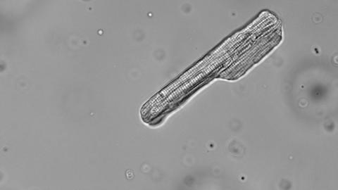 Lichtmikrospische Aufnahme eines Kardiomyozyten kurz nach seiner Isolation aus einem Patienten-Gewebeschnitt.