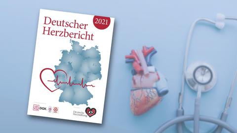 Herzbericht 2022: Daten, Trends und Perspektiven der medizinischen Versorgung von Herzpatienten in Deutschland