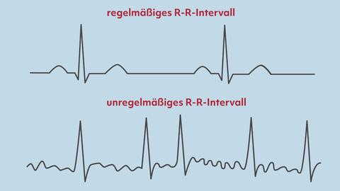 Vorhofflimmern: Diagnose Oft Nur Mit Langzeit-EKG | Herzstiftung