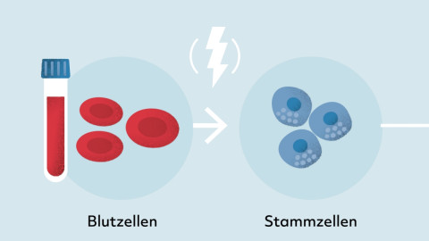 Grafik vom ersten Schritt des Herzpflasters