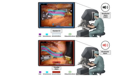 Darstellung vom intelligenten Assistenzsystem für robotergestützte, minimal-invasive Bypass-Operationen